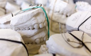 dental teeth