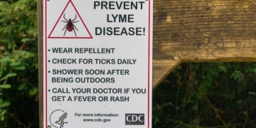Lyme disease